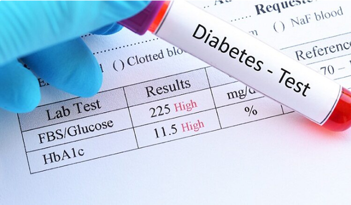 آزمایش خون برای تشخیص دیابت